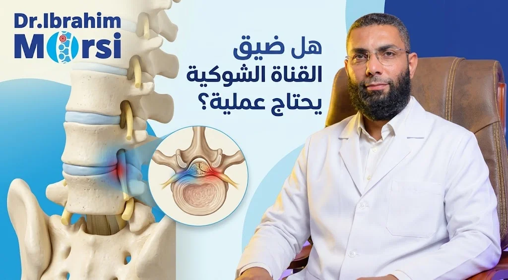 هل ضيق القناة الشوكية يحتاج عملية