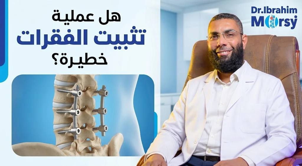 هل عملية تثبيت الفقرات خطيرة